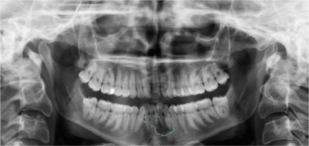 Figure 3.